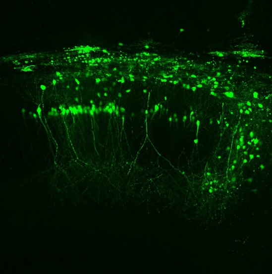 нейроны гиппокампа мыши; гиппокамп как центр памяти с полным правом входит в число самых информированных участков мозга