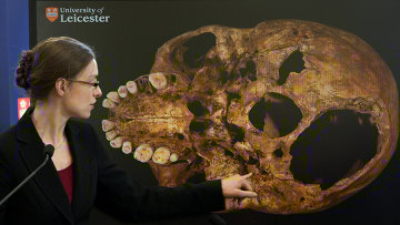 профессор указывает на изображение черепа короля Ричарда III