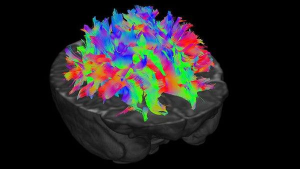 разные цвета обозначают нервные волокна, идущие в разных направлениях – таким образом учёные выясняют, какие именно проводящие пути связывают различные отделы мозга
