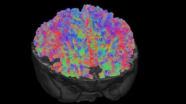 томограф способен зафиксировать 10 млн. проводящих путей в мозге новорожденного, совокупность которых закладывает основу для развития навыков младенца
